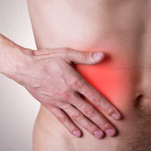 Cirugía de apéndice