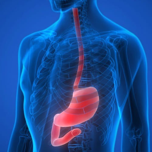 Cirugía de estomago