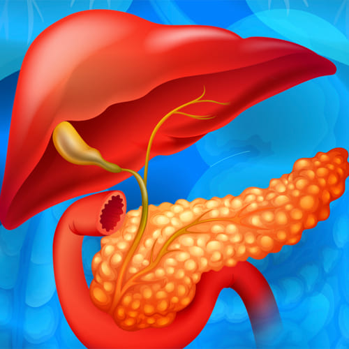 Cirugía de vesícula y vías biliares