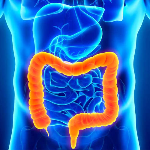 Cirugía intestinal y colónica